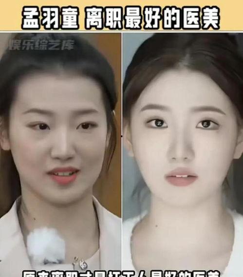 脸上整形视频,跟随视频探索美丽蜕变之路